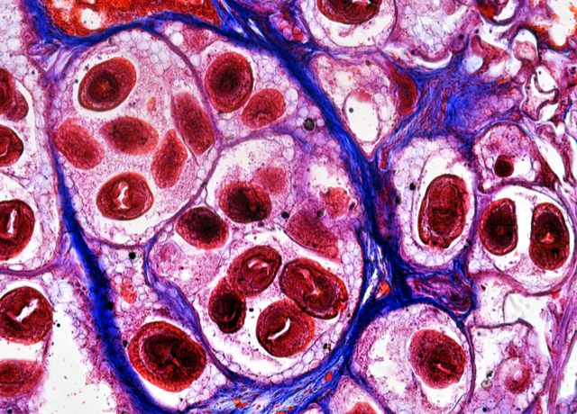 Echinococcus granulosus: epidemiology, diagnosis and control