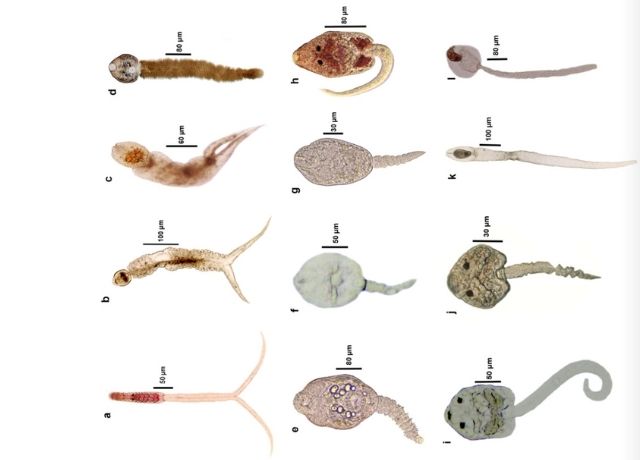 Digenean diversity in snail hosts